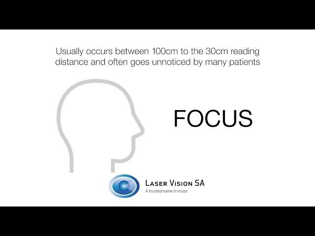 Vision after Trifocal Implants