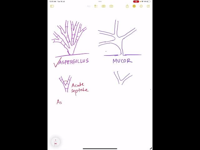 Aspergillus vs Mucor ?
