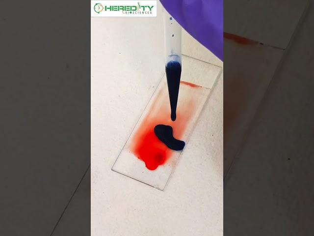 Platelet count of Blood #hereditybioacademy #reels