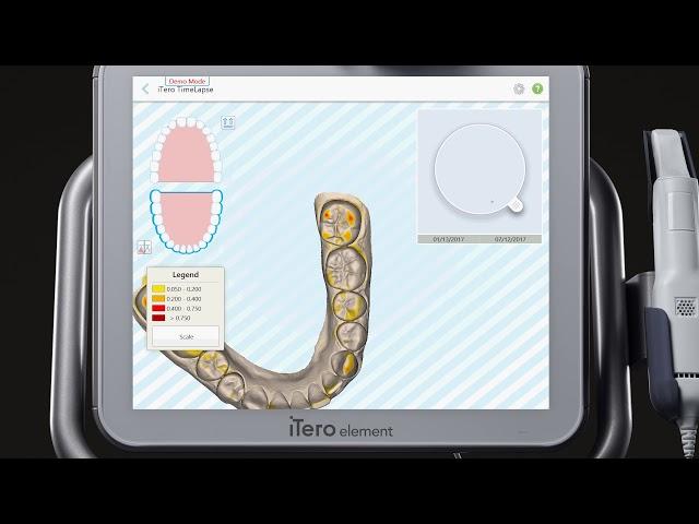 iTero® Scanner Tutorial: Using Demo Mode