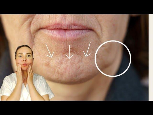 8 min massage for SAGGING JOWLS   and chin tension