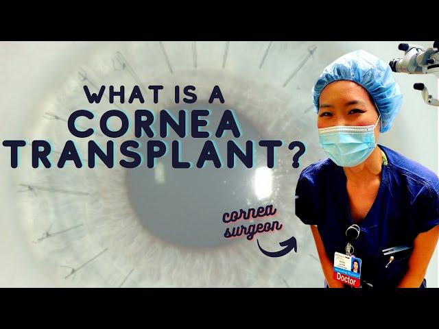 Cornea Surgeon Explains... What is a Cornea Transplant? | Top 3 Reasons For Cornea Surgery!