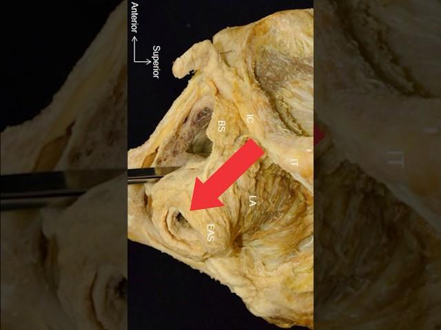 운동하면 항문이 이렇게 됩니다 ㅠ  #education #science #information