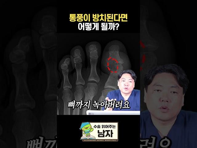 통풍이 방치된다면 어떻게 될까? #통풍 #올바른서울병원 #shorts