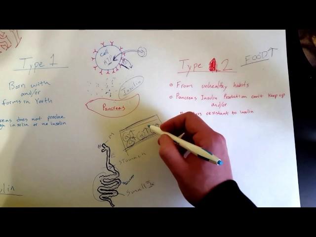 EMT Type 1 & 2 Diabetes / EMT MADE EASY