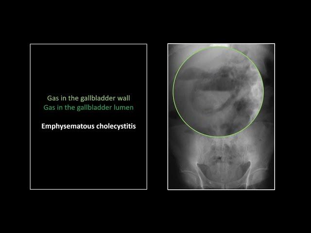 Emergency Abdominal Radiographs | Free Radiology CME