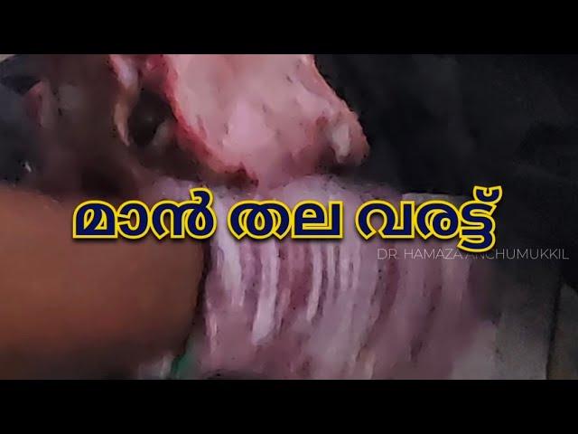 മാൻ തലകൊണ്ട് ഒരു പ്രയോഗം|hamza anchumukkil