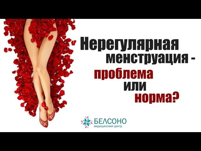 Нерегулярные менструации - проблема или норма? Отвечает гинеколог.