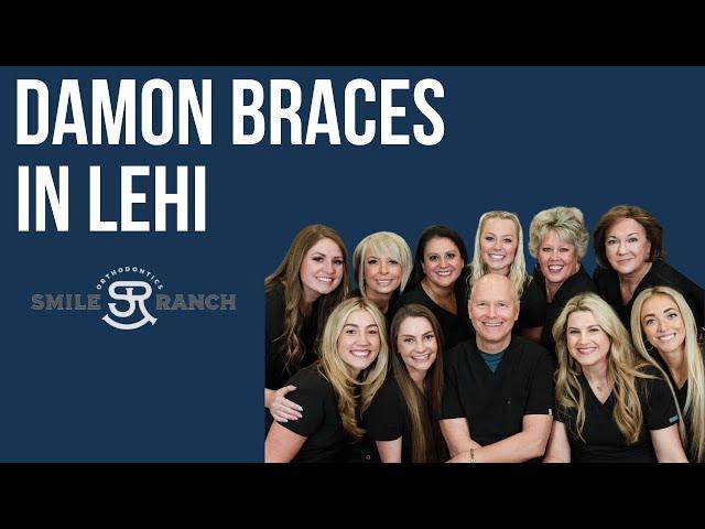 Damon Braces In Lehi