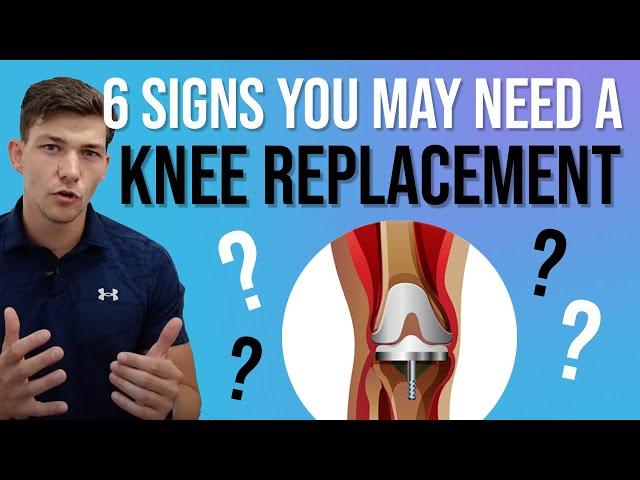 6 Signs a Knee Replacement Is Needed (for Knee Arthritis)