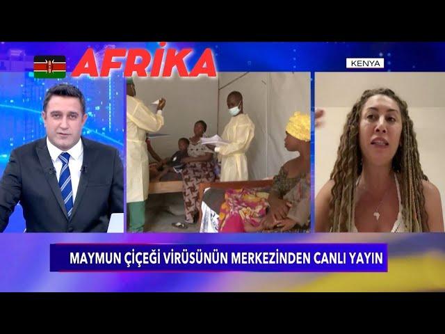 MAYMUN ÇİÇEĞİ Afrika'da Ne Durumda? Nasıl Bulaşır? KENYA