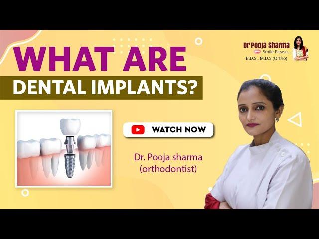 What Is Dental Implant -Treatment in Agra, India | Dr Pooja Sharma | Orthodontic