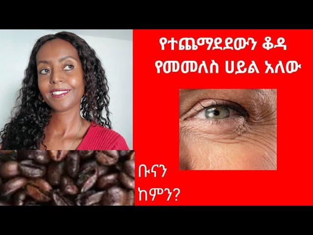 ካፌ ኮፊ ውልደቱ ከከፋ ስለሆነ ስሙንም ከዛው ተወሰደ ለኛ ደሞ የቆዳችን ቦታክስ ሆነ ያውም የተሸበሸበውን የሚወጥር @elsabeautynt @botox