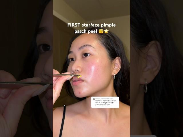 the viral STAR pimple patch…does it work?? 🫣⭐️ #pimplepatch #starface #acneprone