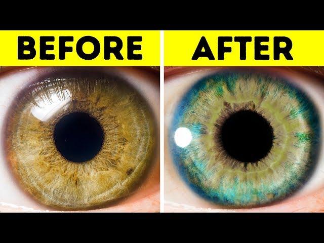 7 Things That Can Change Your Eye Color