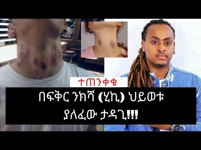 Ethiopia: በፍቅር ንክሻ (ሂኪ) ህይወቱ ያለፈው ታዳጊ!  |WezWez Addis