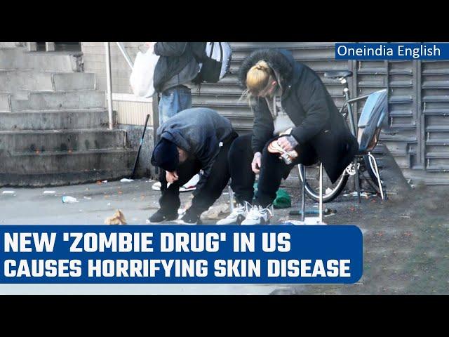 Xylazine: 'Zombie drug' causes menace in US as users get raw wounds on skin | Oneindia News