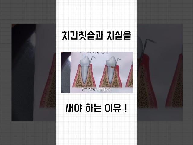 치간칫솔과 치실 사용하고 계신가요? 귀찮더라도 하루에 한번 꼭 사용하세요~~  #잇몸질환 #치과위생사 #구강관리 #치과 #치주염