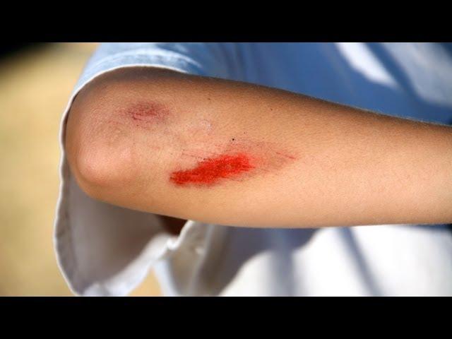 How to Treat Cuts & Scrapes | First Aid Training