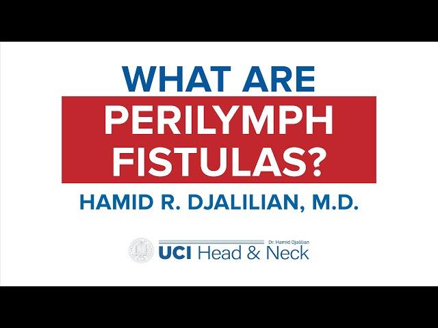 What are Perilymph Fistulas? by Dr. Hamid Djalilian - UCI Head & Neck