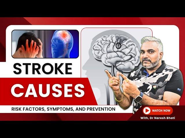 Stroke Causes: Risk Factors, Symptoms, and Prevention with Dr. Naresh Bhati #strokecare #health