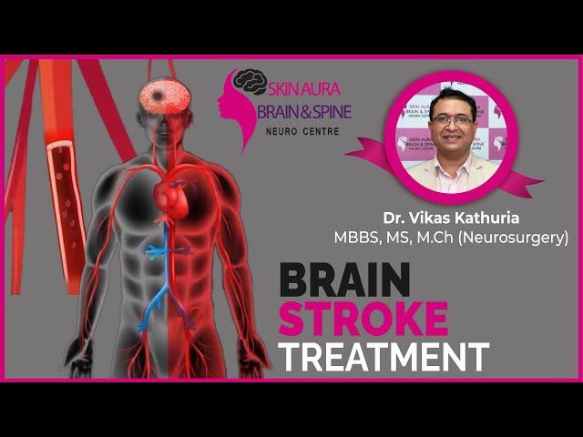 Brain Stroke Treatment | Best Neurosurgeon in Gurgaon- Dr. Vikas Kathuria (Brain Stroke Doctor)