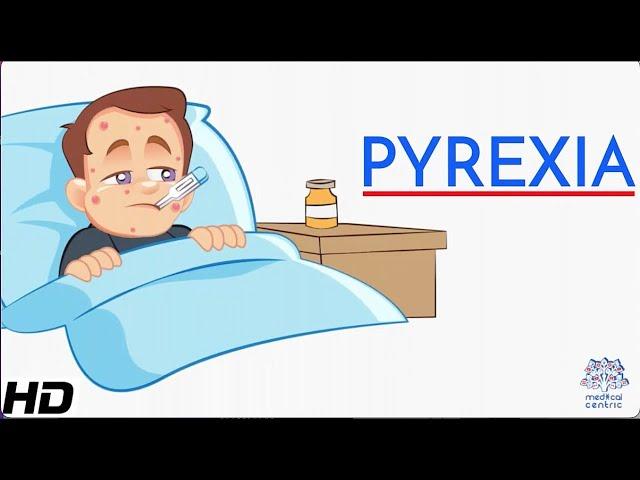 Pyrexia or Fever: Everything You Need to Know