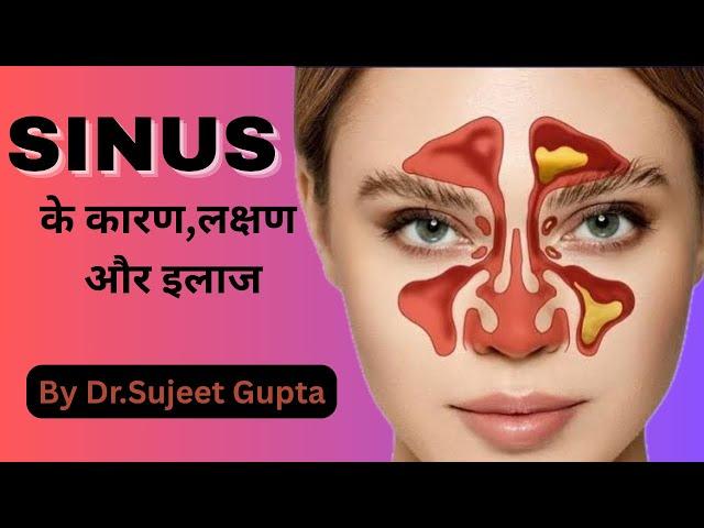 Sinus Infection & Sinusitis Explained: Causes, Symptoms & Treatment | Dr.Sujeet Gupta|