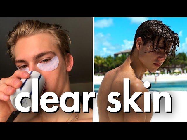 how to get clear skin for guys asap (no bs guide)