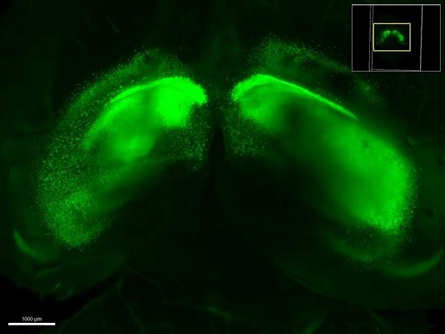 3D-reconstructed cleared brain from a PnTx-Injected Mouse (Post-MWM) (Carmi. I and Bittan M.A)