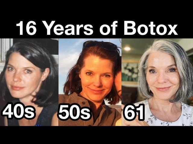 My 16 Year Botox Journey for Preventing Wrinkles | Anti-aging Strategies for 40s, 50s, and 60s