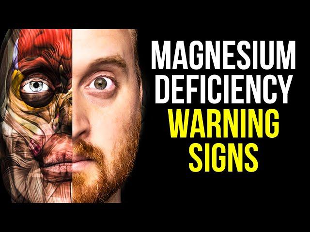 10 Signs of Magnesium Deficiency to Never Ignore