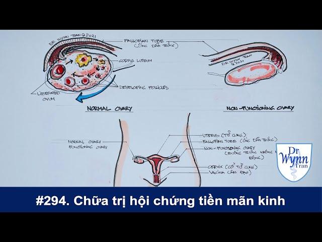 #294. Chữa trị hội chứng tiền mãn kinh thế nào? Dùng hormone có gây ung thư?