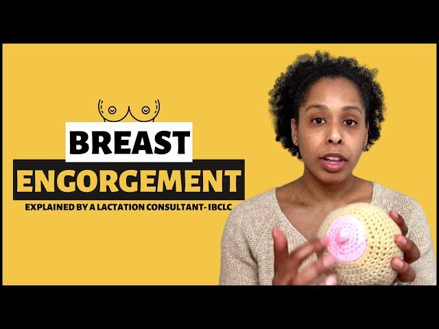 BREAST ENGORGEMENT Postpartum | Causes of Breast Engorgement, Symptoms, Effective Treatments