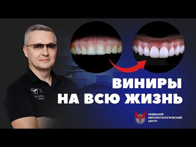 Виниры для зубов. Как ставят виниры, и когда нельзя их ставить?