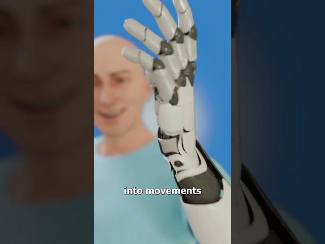 How A Bionic Hand Works 