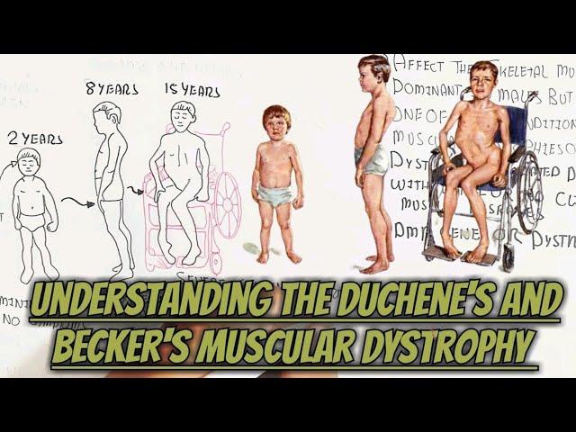 Understanding The Duchene's And Becker's Muscular Dystrophy @umerfarooqbiology7083