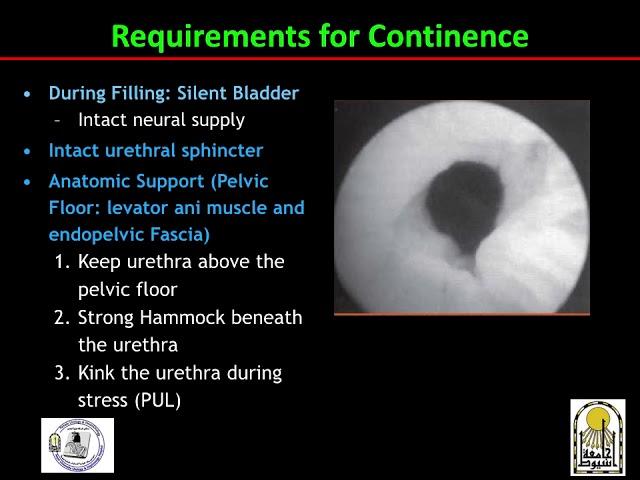 urinary incontinence | urology | 6th grade | Prof.Ahmed Elazab