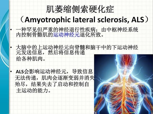 带你走进与生命赛跑的“渐冻人”