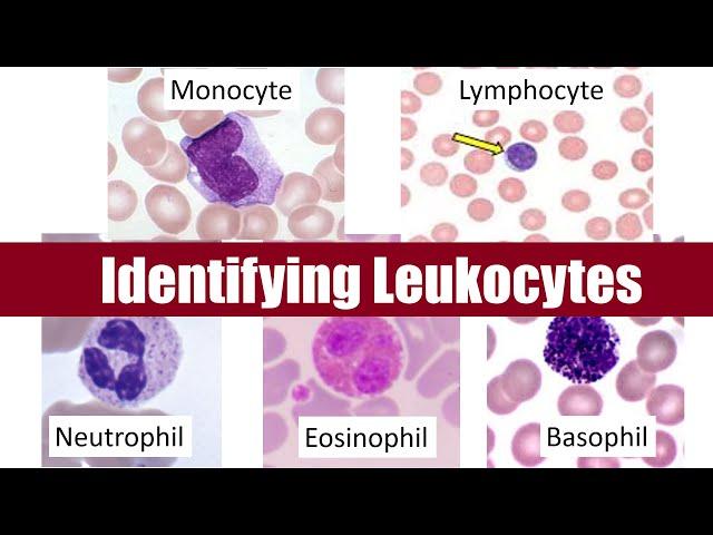Identifying Leukocytes