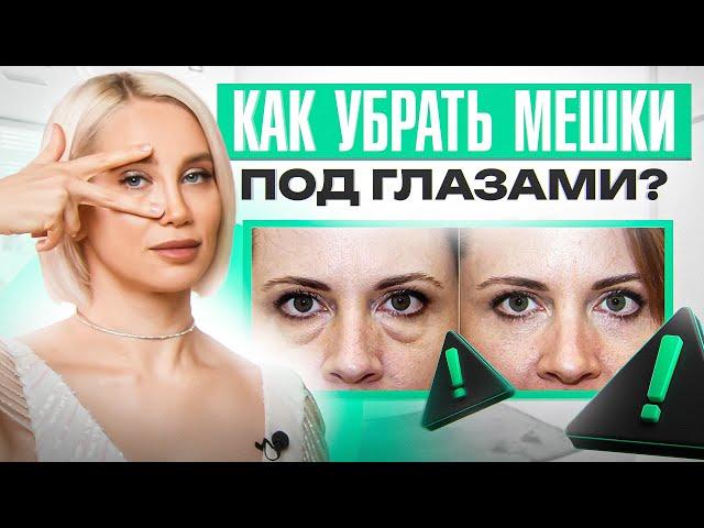 3 ошибки коррекции носослезной борозды, которые приведут к КАТАСТРОФЕ!