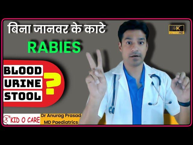 बिना कुत्ता काटे रेबीज हो गया | Non Bite RABIES by Dr Anurag Prasad (HIndi)