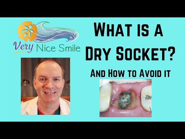 What is a dry socket, why it happens, ways to avoid dry socket, and how to treat dry socket.