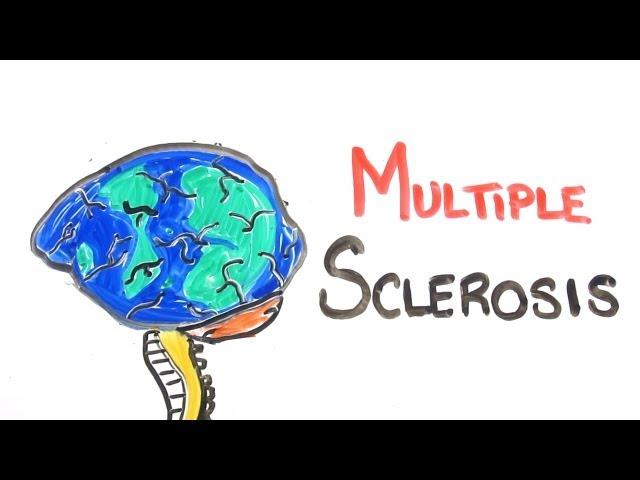 What Is Multiple Sclerosis?