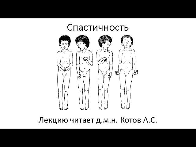 Спастичность