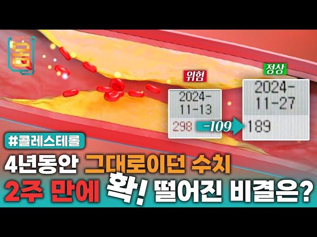 [Full] 4년동안 그대로이던 수치, 2주 만에 확! 떨어진 비결은? #콜레스테롤ㅣ귀하신 몸ㅣ82화 2주의 도전! 콜레스테롤 떨어트리기