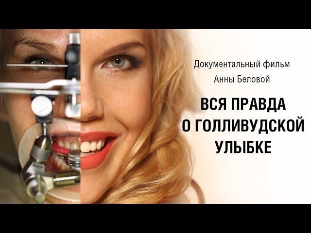 ПРАВДА о ГОЛЛИВУДСКОЙ УЛЫБКЕ! ВИНИРЫ в клинике Implant.ru / ДО и ПОСЛЕ - личный ОПЫТ!  Anna Belle