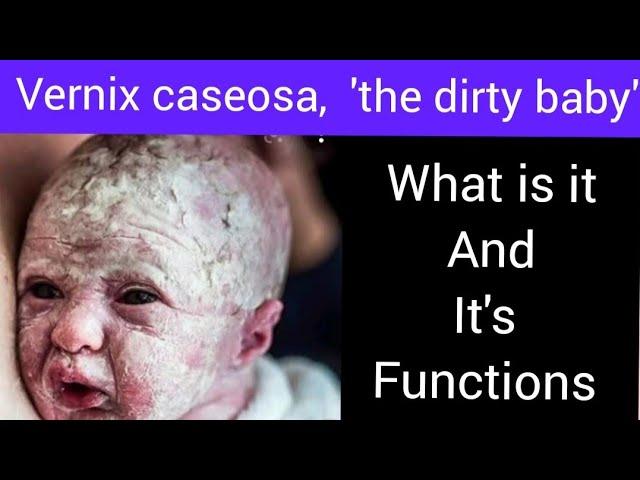 What's vernix caseosa,  what is its benefits??