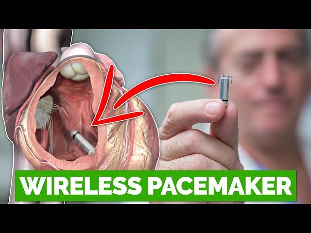 Experimental Wireless Pacemaker Dissolves When No Longer Needed