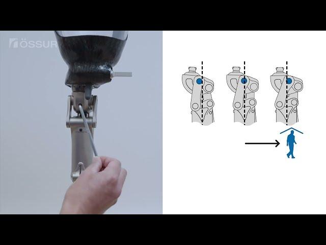 Aspire P1 (Clinician Fitting Tutorial)